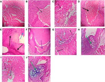 Therapeutic Potentials of Selected Antihypertensive Agents and Their Fixed-Dose Combinations Against Trastuzumab-Mediated Cardiotoxicity